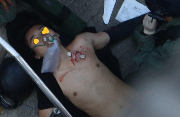 중국 창건 70주년일이었던 1일(현지시간)홍콩 도심에서 열린 반정부 시위에서 18세 소년이 경찰이 바로앞에서 가슴을 향해 쏜 실탄에 맞고 쓰러졌다. 그는 병원으로 이송돼 수술을 받았지만 2일현재 의식불명 상태다.  사진=Jim HorYeung 홍콩통신원.